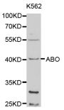 Anti-ABO antibody (54-354) (STJ22473)