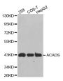 Anti-ACADS antibody (1-260) (STJ22477)
