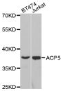Anti-ACP5 antibody (76-325) (STJ22490)