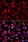 Anti-ACP5 antibody (76-325) (STJ22490)