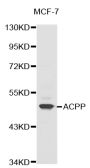 Anti-ACPP antibody (33-386) (STJ22491)