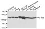 Anti-ACTN2 antibody (1-250) (STJ22501)