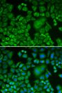 Anti-ACTR3 antibody (1-418) (STJ22503)
