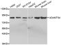 Anti-ADAMTS4 antibody (74-318) (STJ22510)