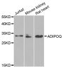 Anti-ADIPOQ antibody (19-104) (STJ22521)