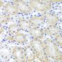 Anti-ADIPOQ antibody (19-104) (STJ22521)