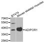 Anti-ADIPOR1 antibody (1-59) (STJ22522)
