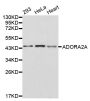 Anti-ADORA2A antibody (300-400) (STJ22527)