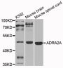Anti-ADRA2A antibody (240-380) (STJ22531)