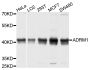 Anti-ADRM1 antibody (108-407) (STJ22536)