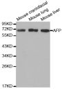 Anti-AFP antibody (360-609) (STJ22541)
