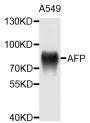 Anti-AFP antibody (360-609) (STJ22541)