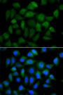 Anti-AFP antibody (360-609) (STJ22541)