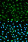 Anti-AHSG antibody (19-300) (STJ22552)