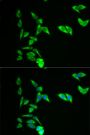 Anti-AK1 antibody (1-194) (STJ22560)