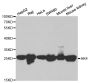Anti-AK4 antibody (1-223) (STJ22562)
