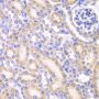 Anti-AK4 antibody (1-223) (STJ22562)