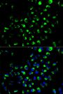 Anti-AK4 antibody (1-223) (STJ22562)