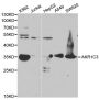 Anti-AKR1C3 antibody (1-323) (STJ22568)
