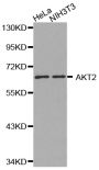 Anti-AKT2 antibody (400-500) (STJ22573)