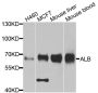 Anti-ALB antibody (25-609) (STJ22574)