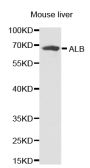 Anti-ALB antibody (25-609) (STJ22575)