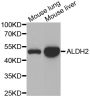 Anti-ALDH2 antibody (321-480) (STJ22581)