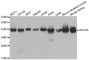 Anti-ALDOA antibody (1-348) (STJ22584)