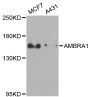 Anti-AMBRA1 antibody (1109-1208) (STJ22601)