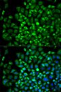 Anti-ANGPTL4 antibody (26-170) (STJ22612)