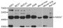 Anti-ANXA7 antibody (237-466) (STJ22622)