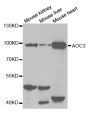 Anti-AOC3 antibody (27-190) (STJ22624)