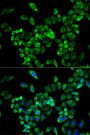 Anti-AOC3 antibody (27-190) (STJ22624)