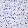 Anti-APEX1 antibody (1-318) (STJ22638)