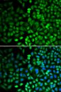 Anti-APEX1 antibody (1-318) (STJ22638)