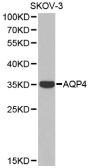 Anti-AQP4 antibody (256-323) (STJ22661)