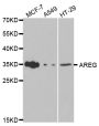 Anti-AREG antibody (20-252) (STJ22665)