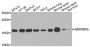 Anti-ARF1 antibody (100-181) (STJ22666)