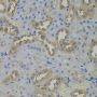 Anti-ARF1 antibody (100-181) (STJ22666)