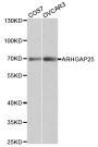 Anti-ARHGAP25 antibody (1-370) (STJ22673)