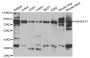 Anti-ARHGEF7 antibody (1-260) (STJ22679)