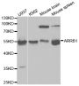 Anti-ARRB1 antibody (169-418) (STJ22692)