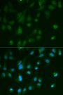 Anti-ARRB1 antibody (169-418) (STJ22692)