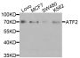 Anti-ATF2 antibody (110-190) (STJ22702)