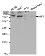 Anti-ATF6 antibody (190-670) (STJ22705)