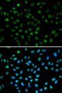 Anti-ATF6 antibody (190-670) (STJ22705)