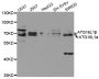 Anti-ATG16L1 antibody (90-300) (STJ22707)