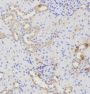 Anti-ATG16L1 antibody (90-300) (STJ22707)