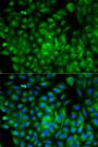 Anti-ATG16L1 antibody (90-300) (STJ22707)