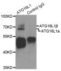 Anti-ATG16L1 antibody (90-300) (STJ22707)